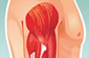 Medical illustration of human right arm muscle