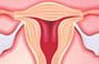 Medical illustration of female reproductive system